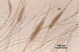 12 – Pseudolaterali del gametofito maschile con spermatocisti